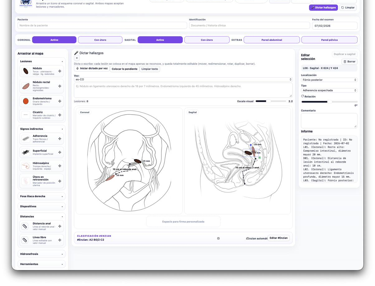 Lesiones mapeadas en esquemas coronal y sagital con clasificación #Enzian generada