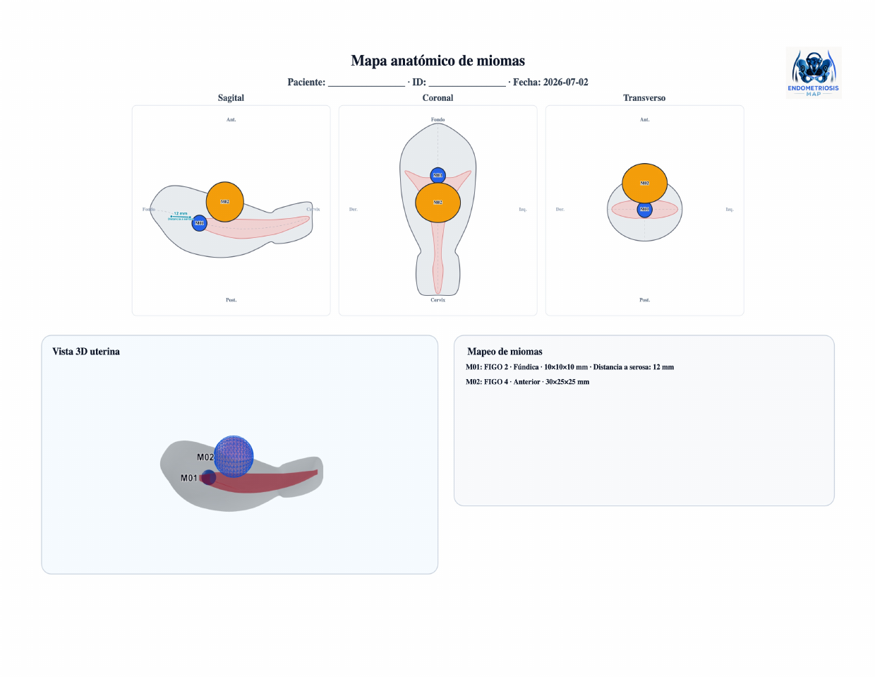 Ejemplo de PDF de mapa anatómico de miomas con cortes sagital, coronal y transverso y vista 3D uterina